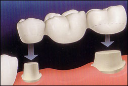 Precision Dental Group