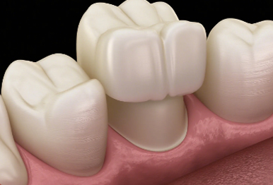CROWNS img