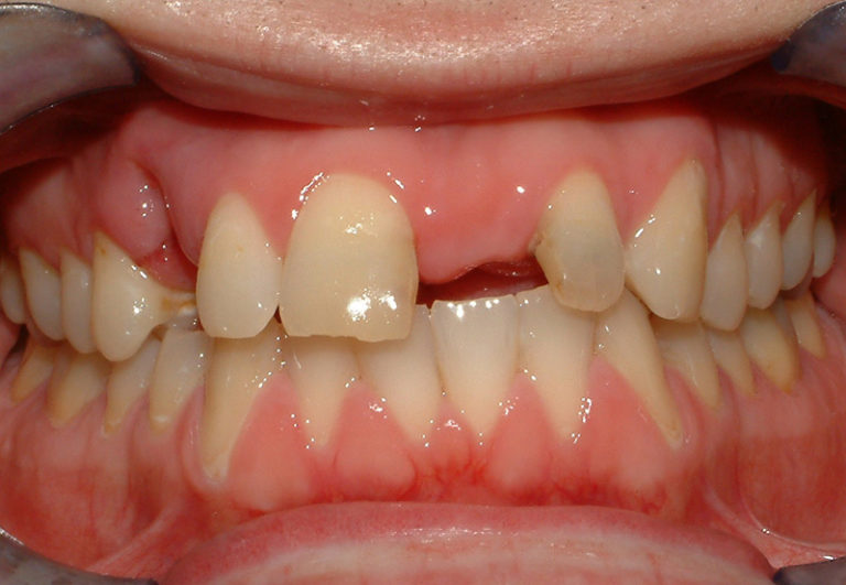 cs3 before 768x531 1