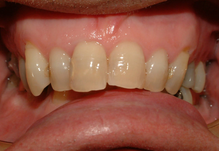 cs7 before 768x531 1