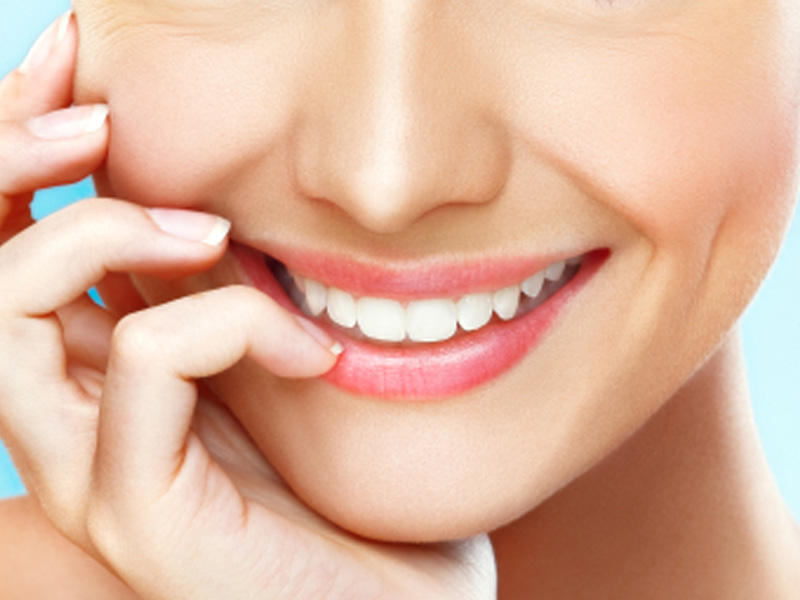teeth whitening gallery